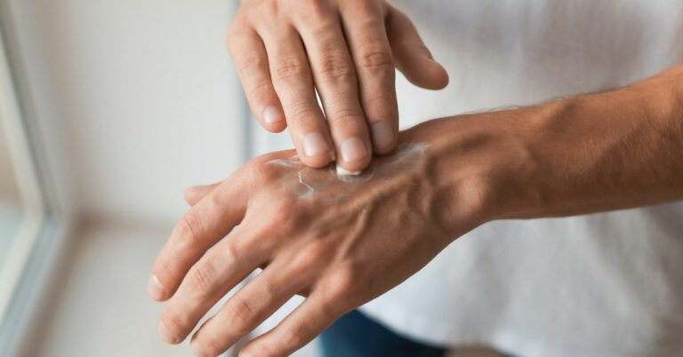 man using topical cbd cream on hand